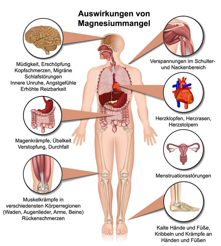 Skizze über Auswirkungen von Magnesiummangel